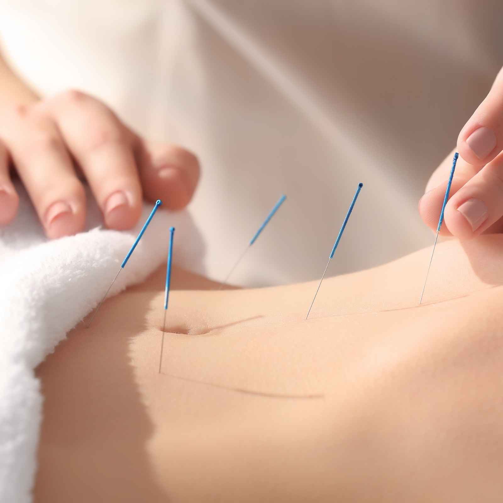 Mariposa Acupuncture in Orillia, Ontario